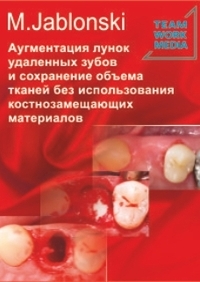Аугментация лунок удаленных зубов и сохранение объема тканей