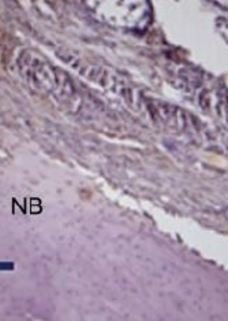 A New Method for Alveolar Bone Repair